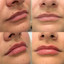 LipFix: LipFlip