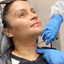 NeckFix: Filler