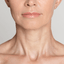 NeckFix: Nefertiti Lift