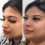 NoseFix: Slimming