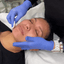 SkinFix: Hydrafacial