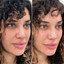SkinFix: Hydrafacial