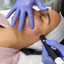 SkinFix: Hydrafacial
