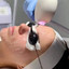 SkinFix: IPL