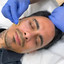 SkinFix: VI Peel