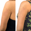 SkinFix: VI Peel