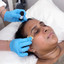 SkinFix: VI Peel