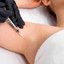 SweatFix: Botox