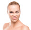 WrinkleFix: Botox (Existing Customers)
