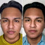 WrinkleFix: Botox (Existing Customers)
