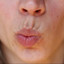 WrinkleFix: Smoker's Lines