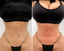AbFix: Venus