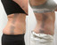 BodyFix: CoolSculpting® Elite