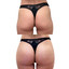 BootyFix: Radiesse Butt Lift