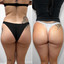 BootyFix: Radiesse Butt Lift