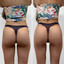 BootyFix: Radiesse Butt Lift