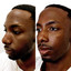 FaceFix: Face Lift for Men