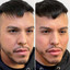 FaceFix: Face Lift for Men