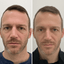FaceFix: Face Lift for Men