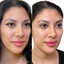 FaceFix: SkinVive