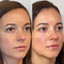 FaceFix: SkinVive
