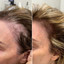 HairFix: Exosomes
