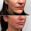 LipFix: Hydrate (SkinVive)