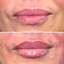 LipFix: Hydrate (SkinVive)