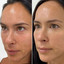 SkinFix: Exosomes