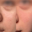 SkinFix: K-Beauty Botox Facial