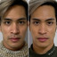 SkinFix: Resurfacing Facial