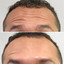 WrinkleFix: ManTox