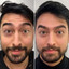 WrinkleFix: Unlimited Toxins Membership