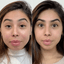 WrinkleFix: Unlimited Toxins Membership