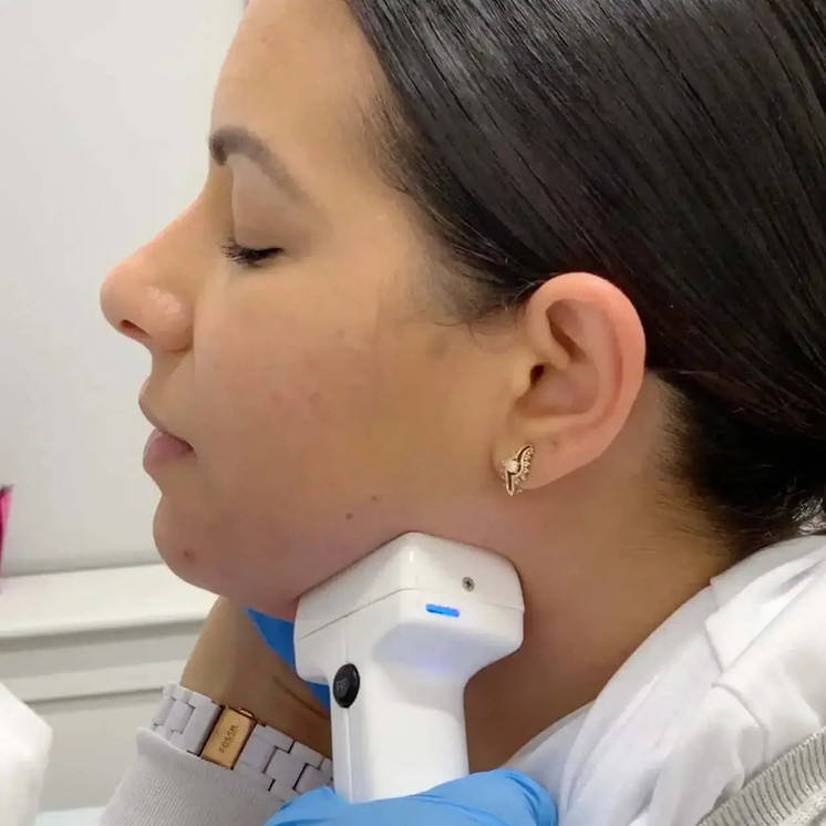 ChinFix: truSculpt iD