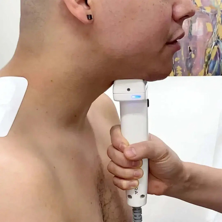 ChinFix: truSculpt iD