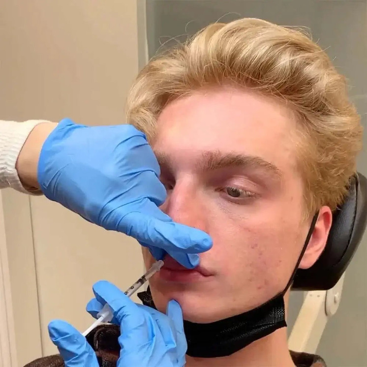 LipFix: LipFlip