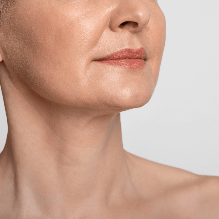 NeckFix: Nefertiti Lift