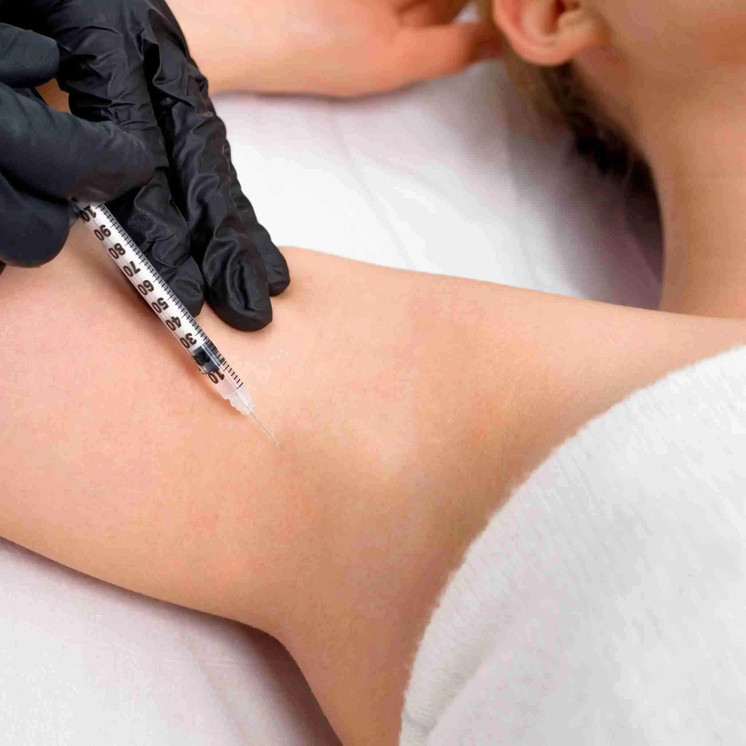 SweatFix: Botox