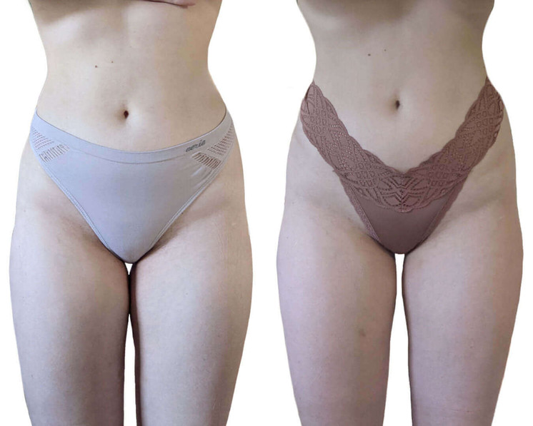 BodyFix: CoolSculpting® Elite