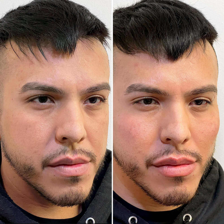 FaceFix: Face Lift for Men