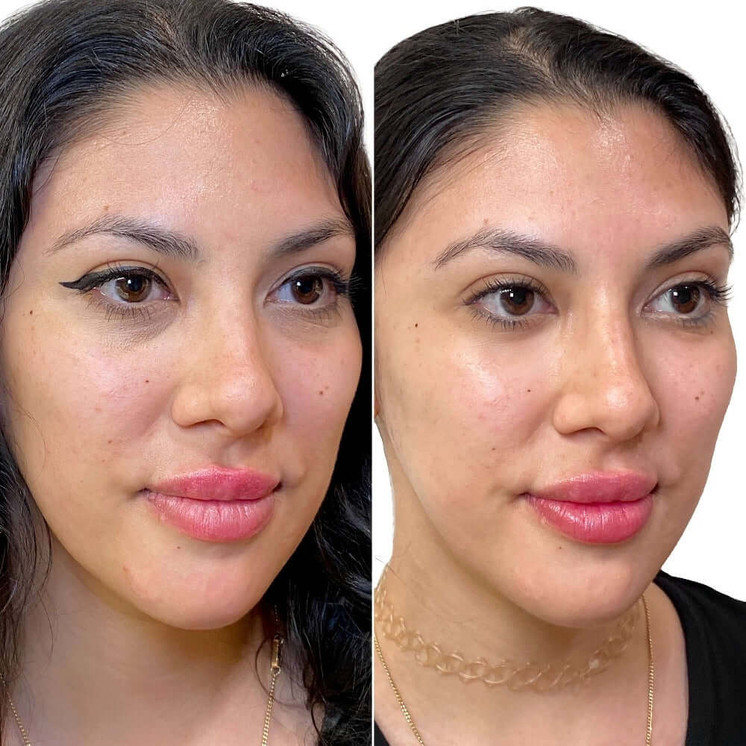 FaceFix: SkinVive