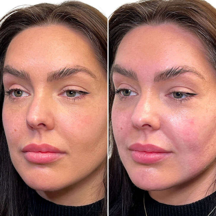 FaceFix: SkinVive