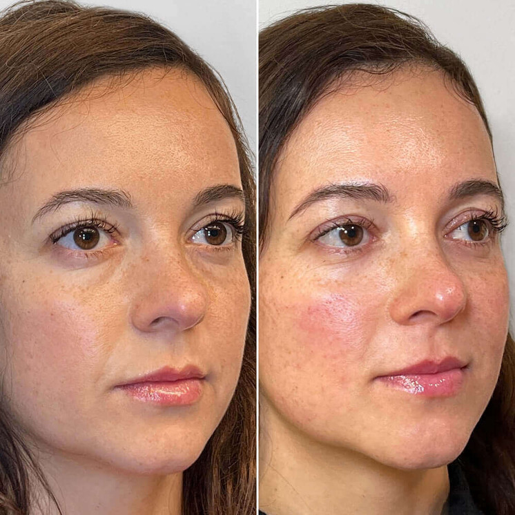 FaceFix: SkinVive