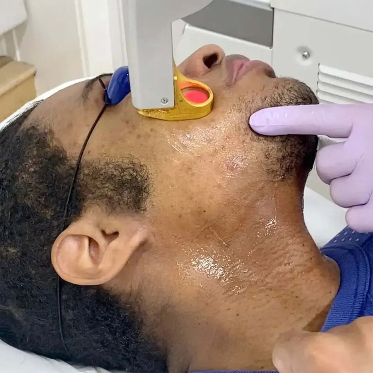 HairFix: Laser Hair Removal Medium