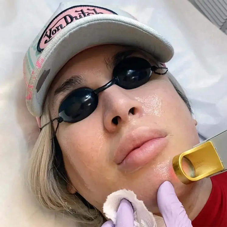 HairFix: Laser Hair Removal Medium