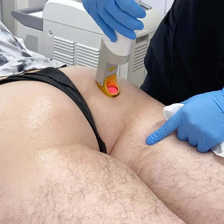 HairFix: Laser Hair Removal Medium