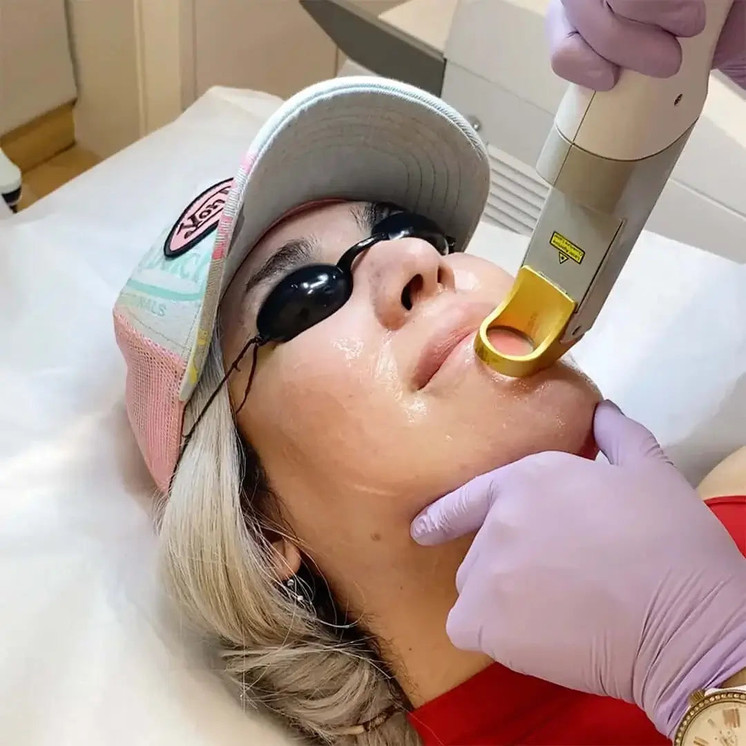 HairFix: Laser Hair Removal Small