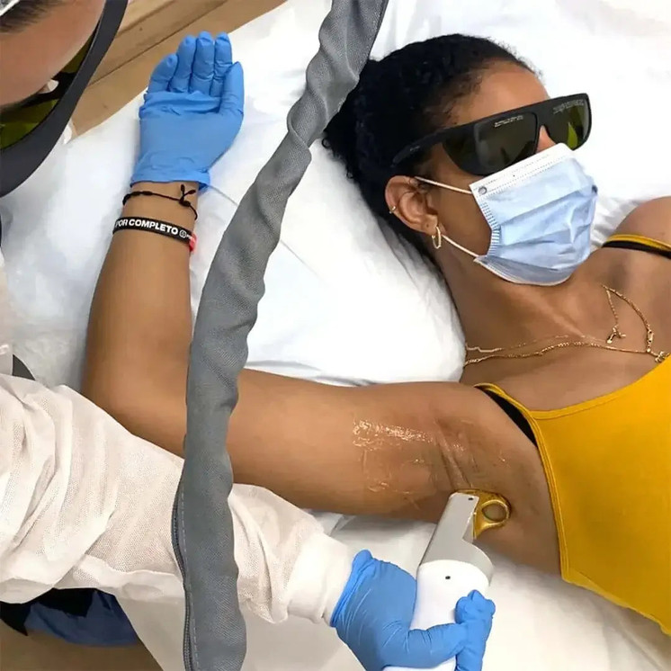HairFix: Laser Hair Removal Small