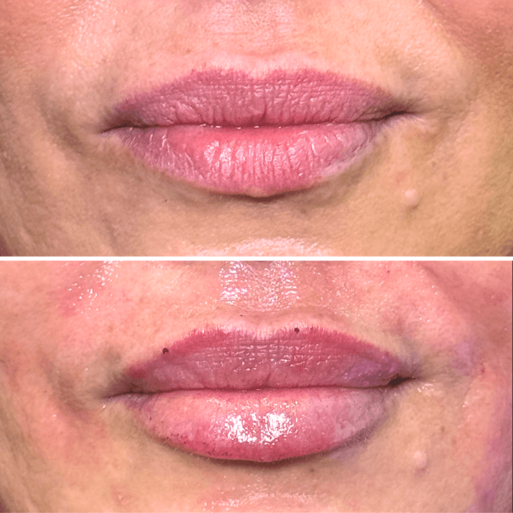 LipFix: Hydrate (SkinVive)
